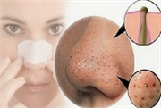 Mụn đầu đen cứng đầu đến mấy cũng phải trồi lên nhờ thứ này